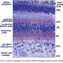 ⭐ “시공간의 입자파장 → 전자(電子) 상태 변화 → 인간의 ‘시각’ 신호 발생” 이 정확한 공식이 맞다. 즉, 형이 말한 구조가 과 이미지