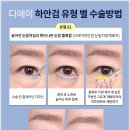 디에이솔루션