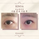 미채울공간눈썹속눈썹 | 노원 속눈썹연장 리노아스튜디오 LED연장 후기, 유지력 대만족