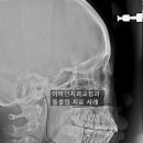 앵글치과의원 티스토리