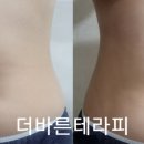더바른테라피 이미지