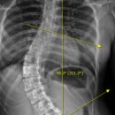 아람메디 이미지