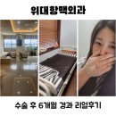 조남천항맥외과의원 | 위대항맥외과 치핵수술 6개월 경과 리얼후기, 한가지 단점