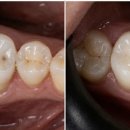 ONE치과기공소 이미지