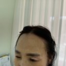 [청주 복대동 SMP] 여자 헤어라인 후기 (+찐리액션🤍)