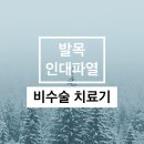 발목인대파열 비수술 7주간 치료후기 / 4개월 지난 현상태 업데이트
