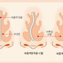 정이비인후과의원 이미지