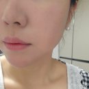 토토홈케어 | 판테놀성분 화장품 오돌토톨 붉은기 붓기진정잡고 피부장벽회복 리얼후기
