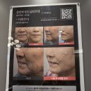 인천마디병원 | 인천송도피부과 미희주사 후기, 볼꺼짐 고민 해결해 준 콜라겐주사 효과 정리