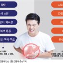 [특별연재] 간장질환자의 치과치료(3) 이미지