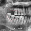 하모니치과기공소 네이버블로그