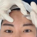 부산서면닥터에버스의원 네이버블로그