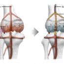 오브이메디컬 이미지
