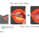 정한수비뇨기과 이미지