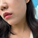 신사동-3 | 에이브의원 신사동 온다리프팅 주기 3회차 후기 이중턱 없애기