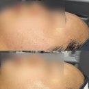 전주 송천동 에스테틱 르클레어 후기