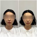 29 | 양산윤곽관리받고 턱선 달라진 물금 더웰에스테틱 후기