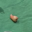 잘가요사랑니치과의원 이미지