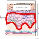우리 피부