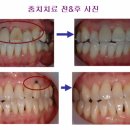 e-플랜트치과 이미지