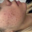 솜 에스테틱 이미지