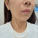 광주실리프팅 잘하는 곳 마리오넷 실리프팅 땡김이주사 후기 광주피부과