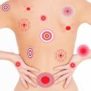 오버도즈 이미지