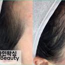 뷰티케어 네이버블로그