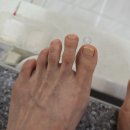 대전 괴정동 패디 뮬랑네일 문제성발톱 전문샵