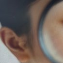 바르다성형외과의원 네이버블로그