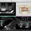 백치과기공소 이미지