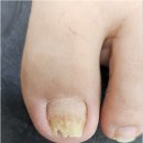 네일크루 이미지