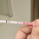 2줄 임테기 후 포상기태 진단… 증상, 초음파, 소파술까지 솔직 후기