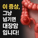 “이 증상, 대장암 초기신호입니다!”