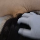 평택승모근관리 고덕에스테틱 도도에스테틱 등관리 후기