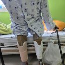 참의수족보조기 이미지