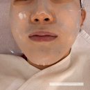 회기17 | 회기여드름관리 노메러스킨 문제성피부케어 받아본 상세 후기