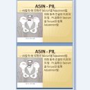 골반교정Pelvis Rt. Ilium PI Listing Adjustment 이미지