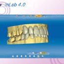 리더스 치과기공소 이미지