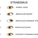 언커버안경원 이미지