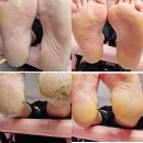 블링네일