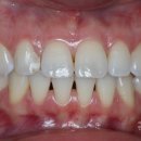 연세리버힐치과의원 이미지