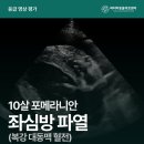 Dr.dog동물의료센터 | 대구 좌심방 파열 치료 (10살 포메라니안 치료 후기) | 파티마동물의료센터