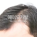 에이모가발 이미지
