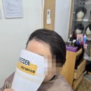 마루가발 | 부산 여자 가르마가발 후기 흉터까지 자연스럽게 커버돼서 자신감이 생겼어요