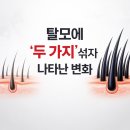 주식회사제이유 | 탈모약 두 가지 병용 효과, 놀라운 변화 이유