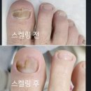 려원네일& 레푸스 네이버블로그