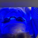 턱라인 살아나는 윤곽관리 성남피부관리 더예쁨 하이푸리프팅