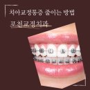 서울에스(S)치과교정과치과의원 | 포천교정치과 치아교정 통증 줄이는 방법! 20년 경력 교정과 전문의가 알려 드림!