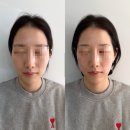 제이 메디칼 | 광주 양산동 제이샵뷰티 “알테온 리프팅” 팔자랑 윤곽부터 피부결까지 올인원 후기